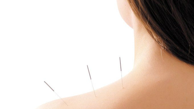 Acufacial vs. Medical Aesthetics: What’s the Real Difference?