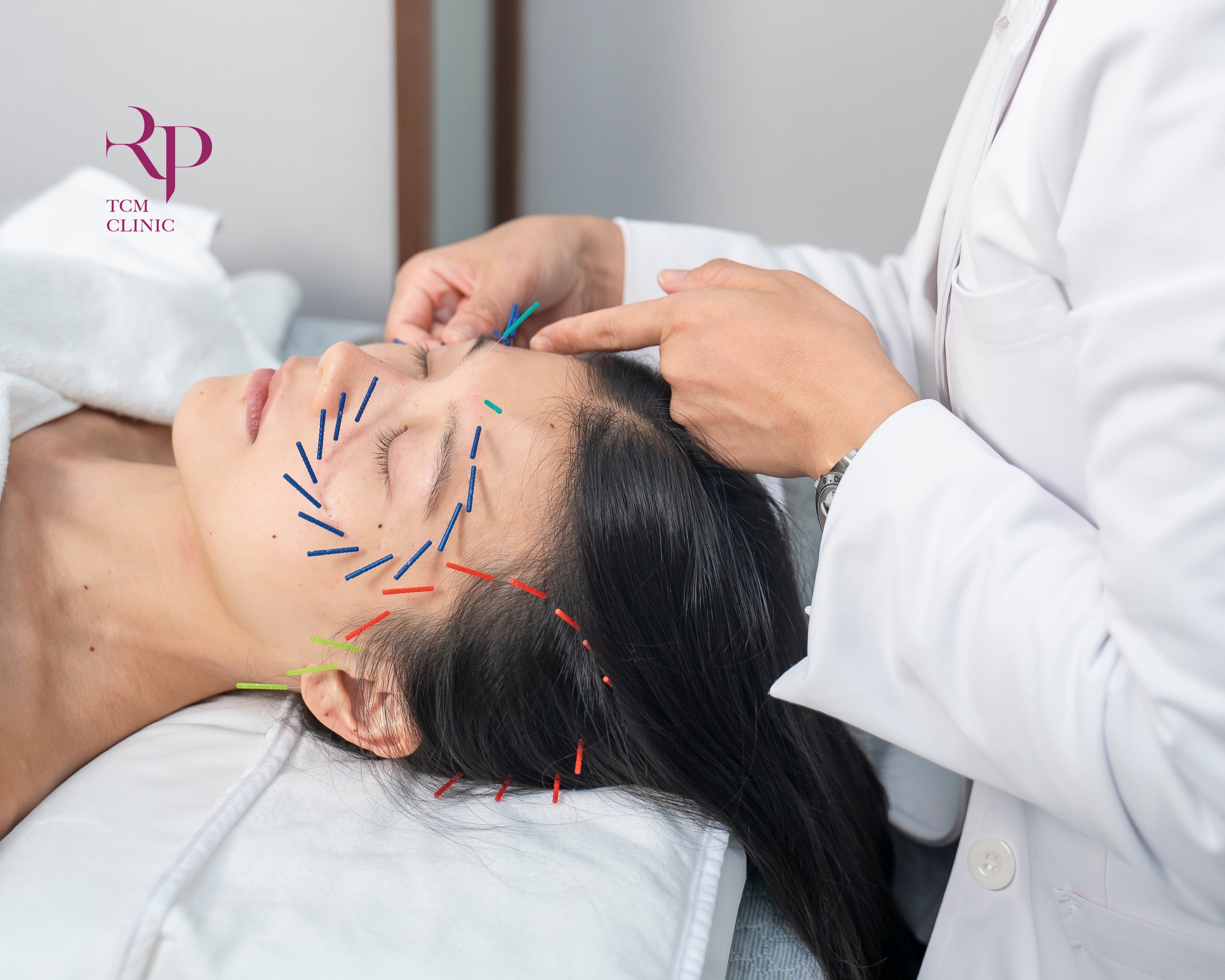 Person receiving acupuncture treatment with needles on a white background