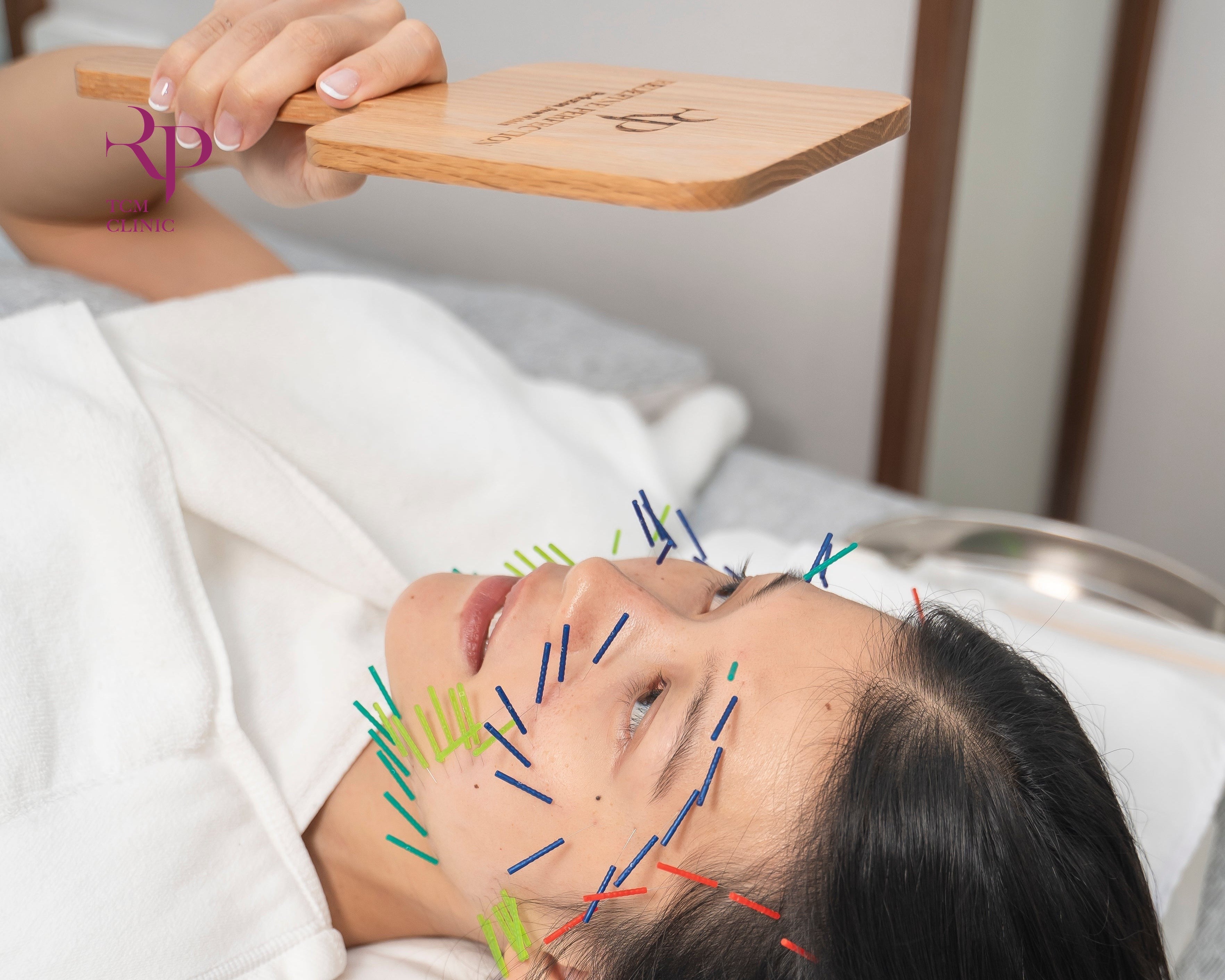Woman receiving acupuncture on her face with needles inserted into her skin.