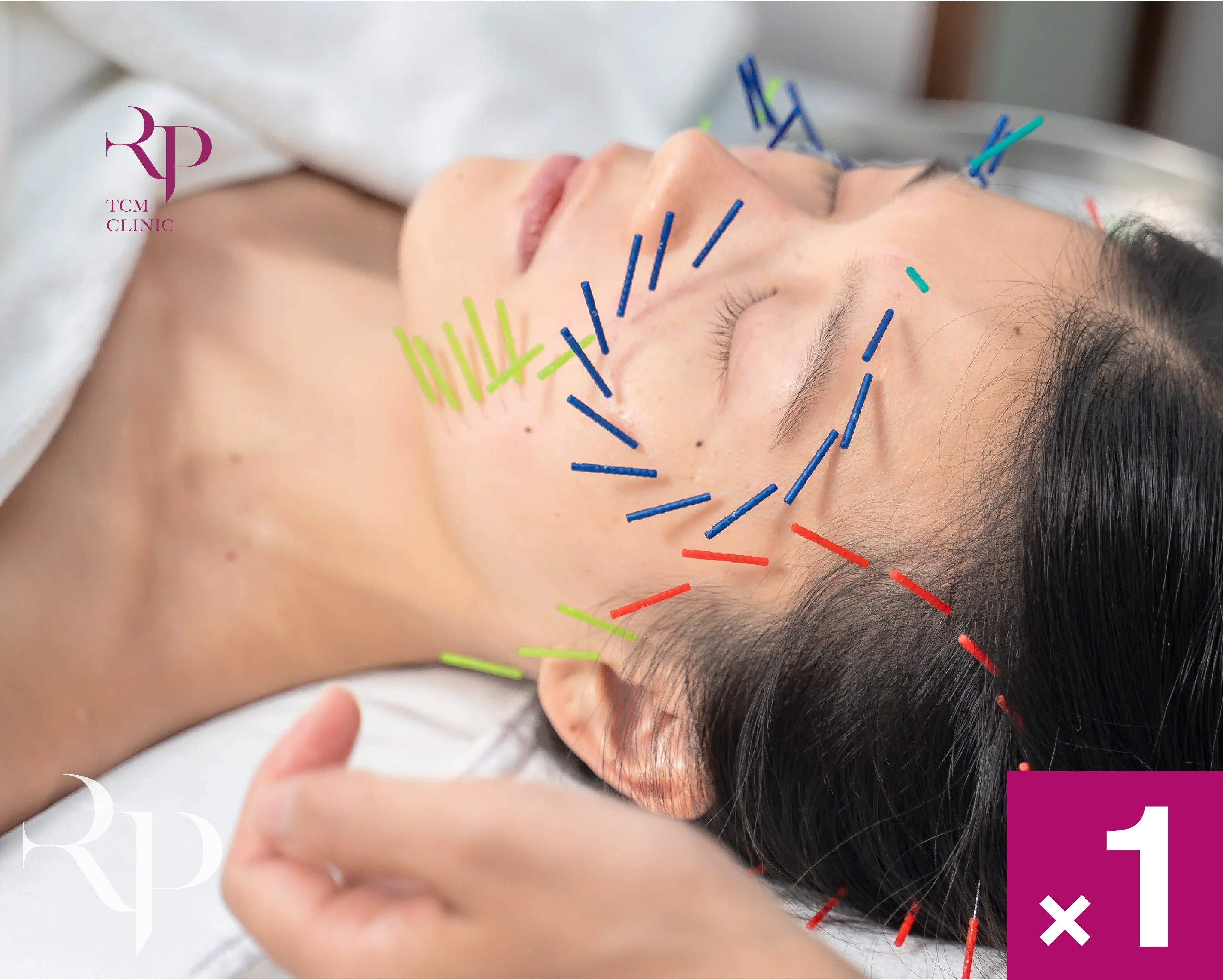 Person receiving acupuncture treatment on their face with needles of different colors.